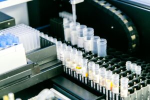 High angle of plastic containers with various samples placed in modern light lab